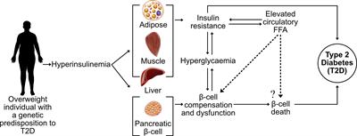 Beta cell lipotoxicity in the development of type 2 diabetes: the need for species-specific understanding